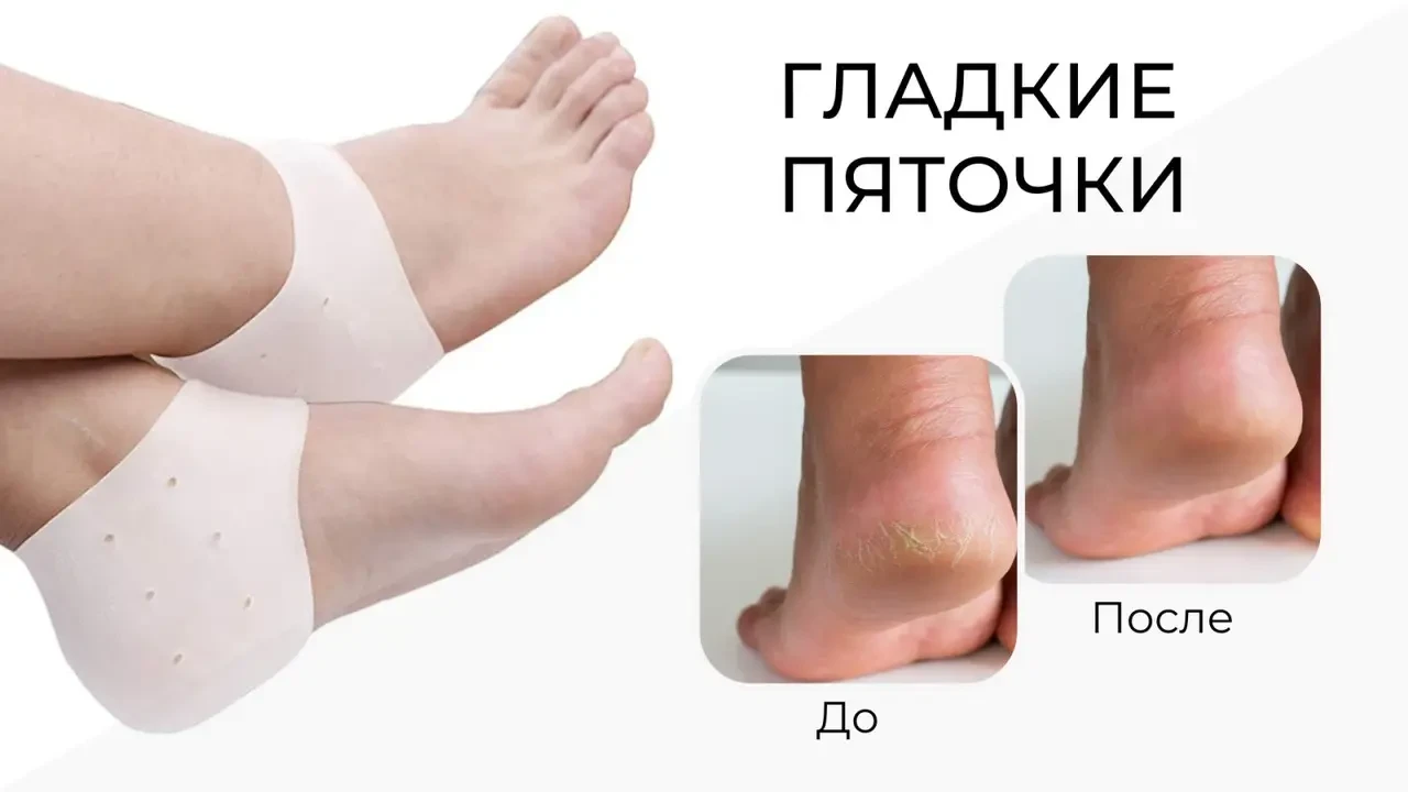 Протектор на пятку для взрослых Valgus Pro with hole 2шт (White) (16375)